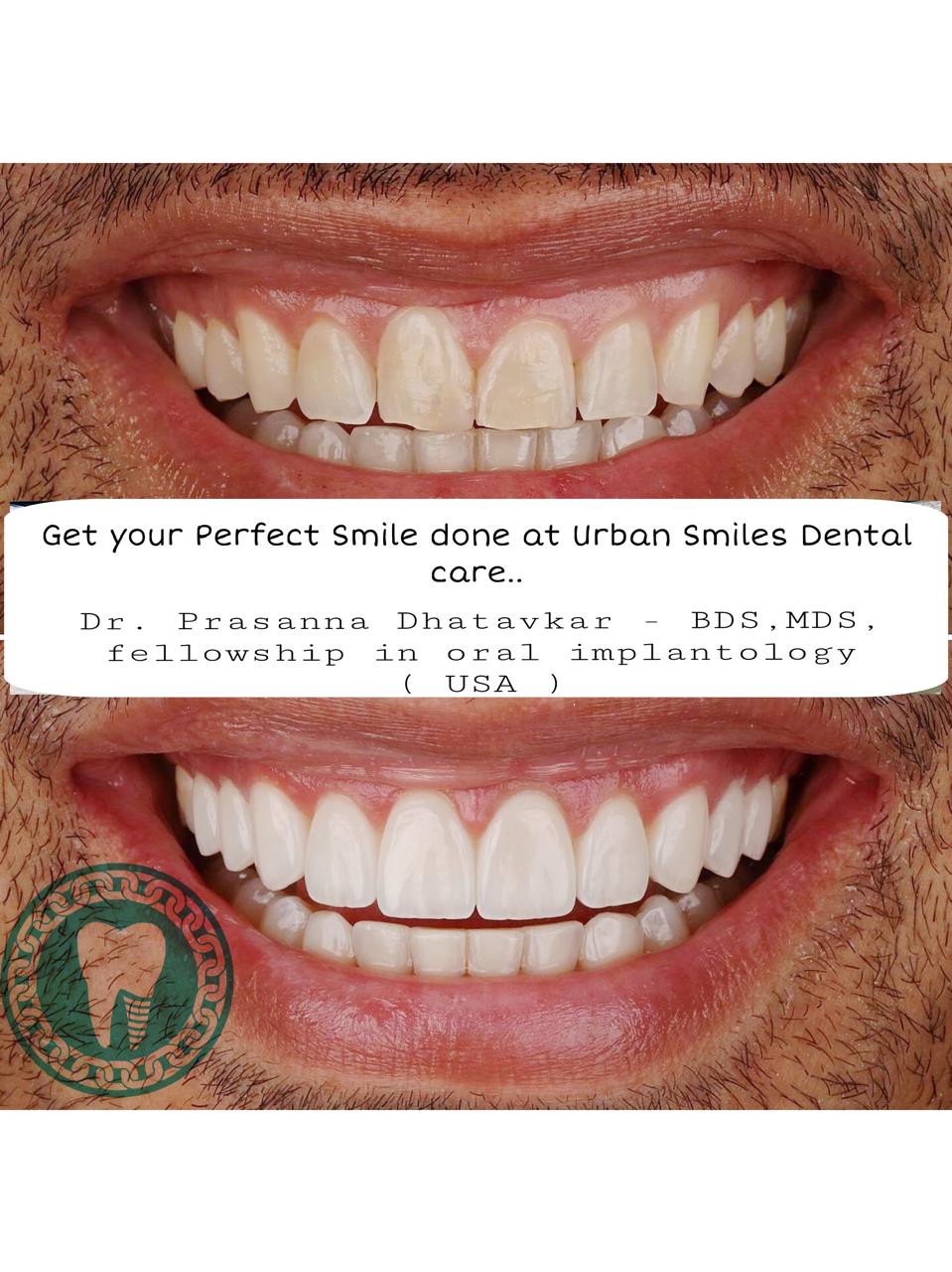 Patient at Urban Smiles Dental Care, Chembur