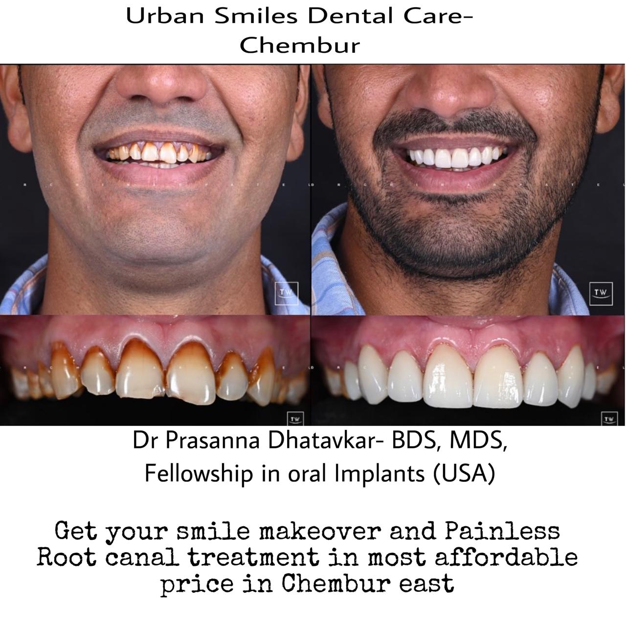 Patient at Urban Smiles Dental Care, Chembur