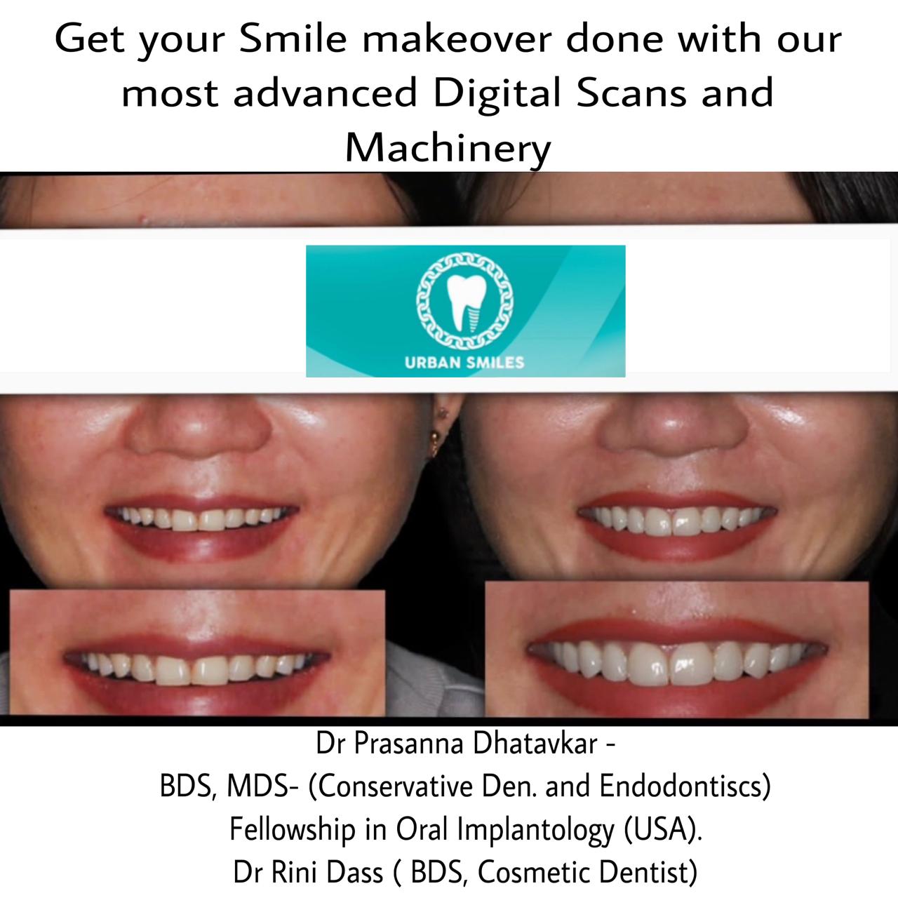 Patient at Urban Smiles Dental Care, Chembur