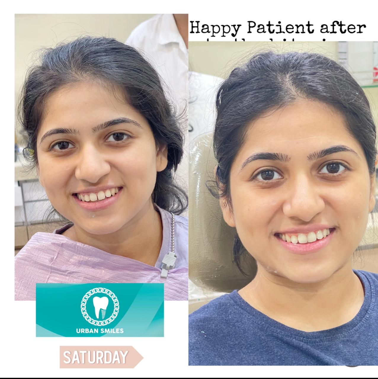 Patient at Urban Smiles Dental Care, Chembur