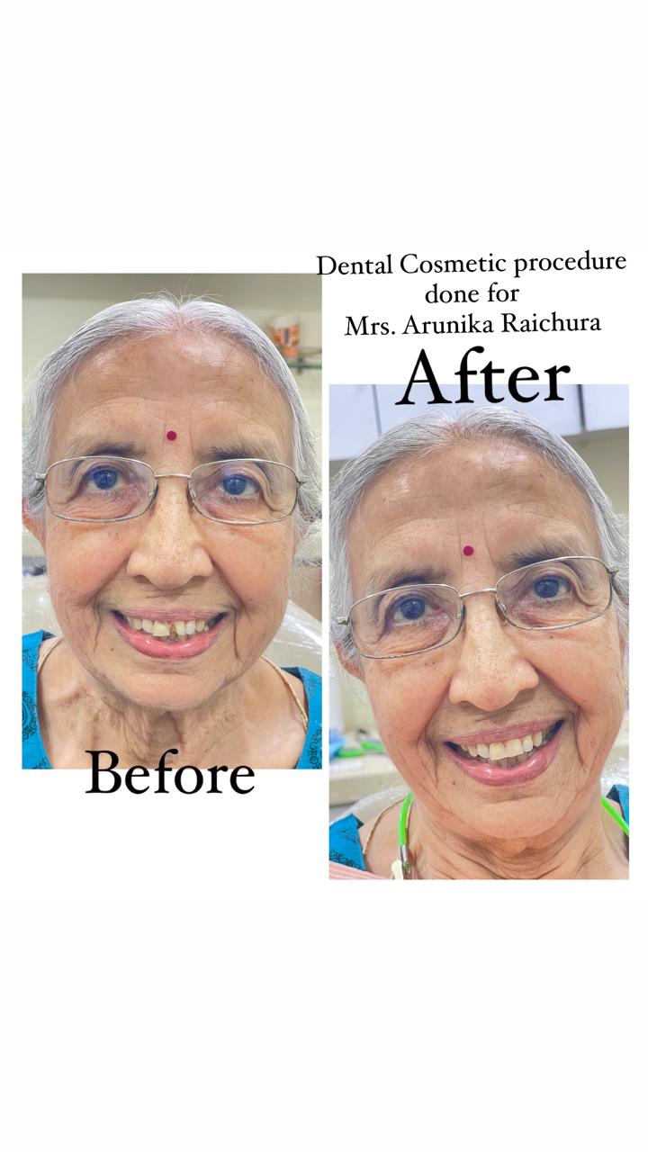 Patient at Urban Smiles Dental Care, Chembur